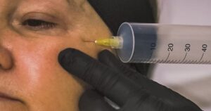 Consultório de Terapias Integrativas: Ozonioterapia, Injetáveis, Laser e Tratamento para DOR